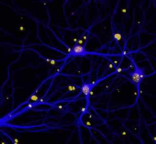 BRCA1 in neurons 320