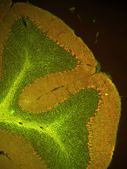 Proteine immunitarie, come secondo lavoro, regolano le connessioni tra le cellule del cervello
