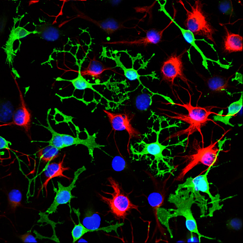 Cellule staminali neurali: nuovo approccio per riparare i danni dell'Alzheimer.jpg
