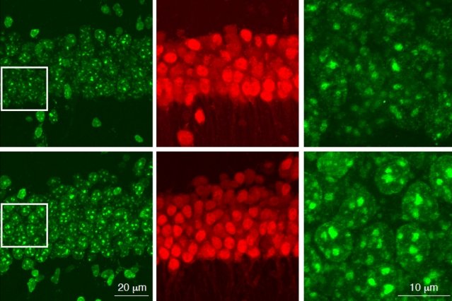 MIT Aging Neurons 0