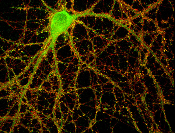 Proteine immunitarie, come secondo lavoro, regolano le connessioni tra le cellule del cervello