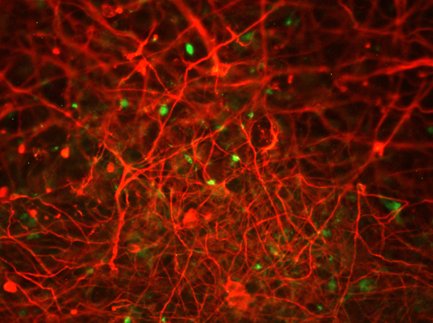 Studio: 'le placche da sole non sono sufficienti a uccidere i neuroni'