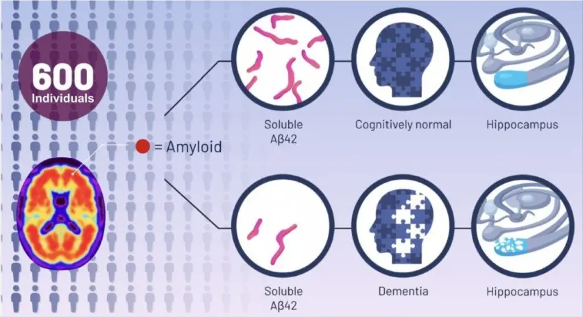 comparing brain protein fluid levels in individuals with amyloid plaques