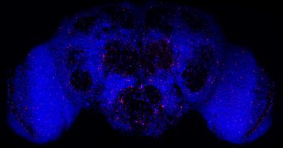 drosophila brain loosing neurons