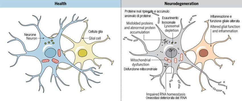 healthy and degenerated neuron