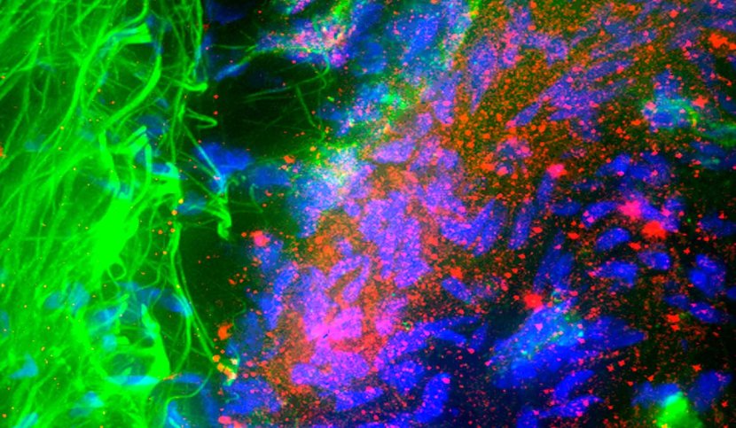 Punti quantici nel cervello potrebbero trattare Alzheimer e Parkinson