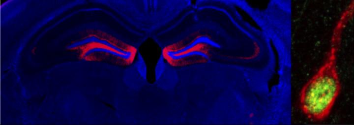 La corale della memoria: per preservare i ricordi, il cervello deve regolare le reti neurali