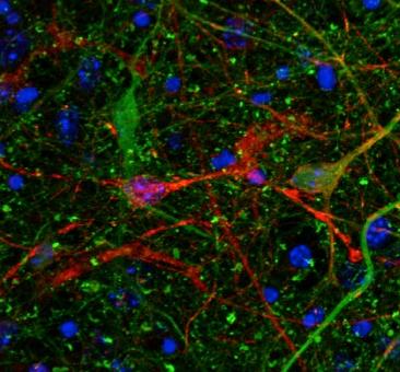 Le proteine Tau si diffondono nel cervello nello spazio extracellulare