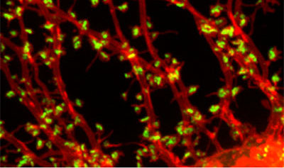 Ricercatori riescono a vedere la comunicazione tra i neuroni