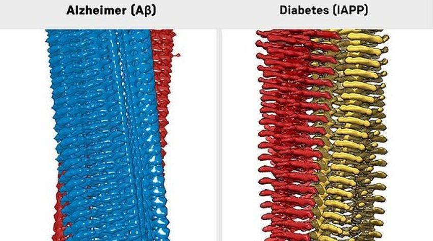 3D reconstruction amyloidbeta and IAPP fibrils