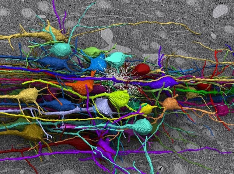 In viaggio nel cervello attraverso immagini mozzafiato in technicolor