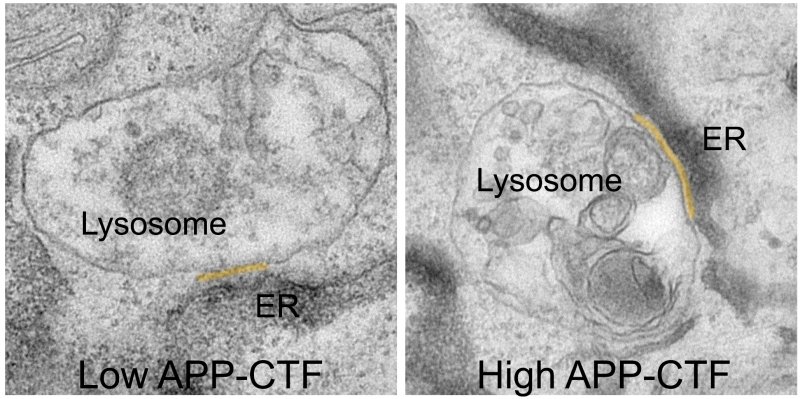 APP CTF accumulate between the endoplasmic reticulum and the lysosomes