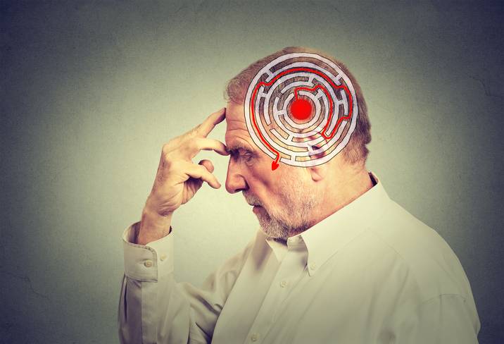 Alzheimer sembra arginato, ma non fermato, dicono gli esperti