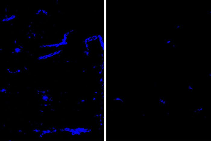 Amyloid deposits blue in mouse brain tissue