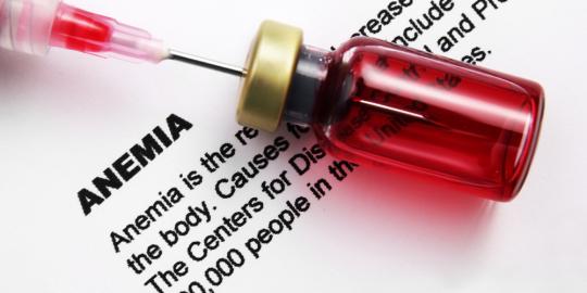 Anemia Types Treatment Causes Sign and Symptoms
