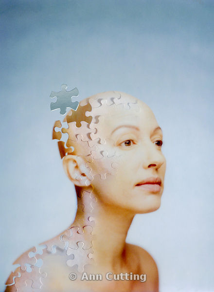 Alzheimer: il puzzle complesso della neurodegenerazione