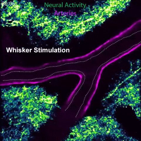 Arteries in a mouse brain dilate in response to local neural activity