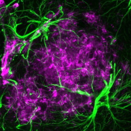Le 'stelle nascenti' del cervello: nuove opzioni contro l'Alzheimer?