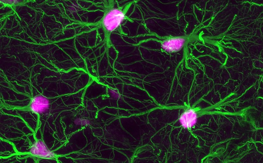 Astrocytes green with more STAT3 activatiion magenta