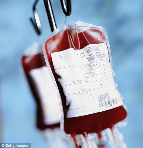 Studio dimostra efficacia di infusioni di sangue per ritardare l'insorgenza dell'Alzheimer