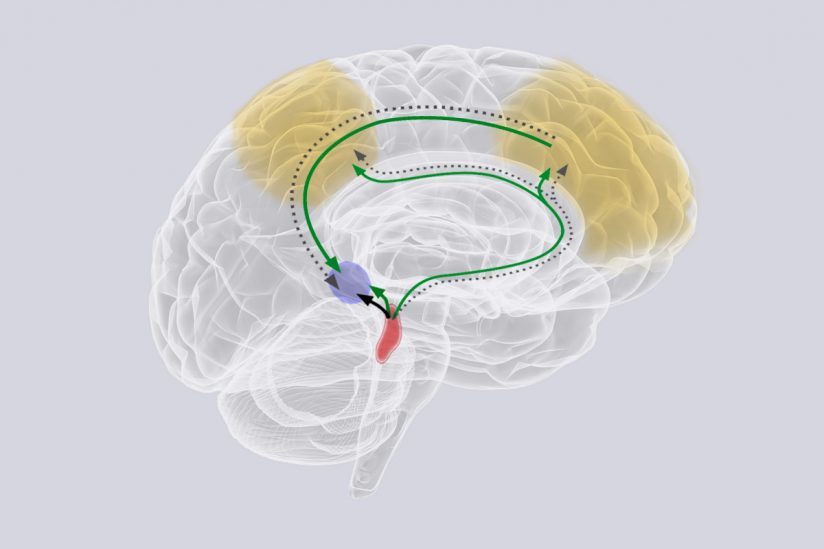 L'epicentro dell'Alzheimer nel cervello è anche la fonte della distraibilità degli anziani