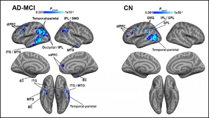 Brain regions with negative correlation between blood flow and tau