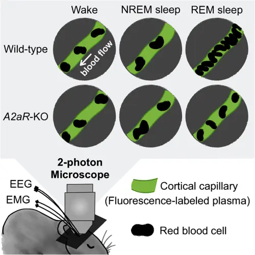 Brain blood flow during sleep