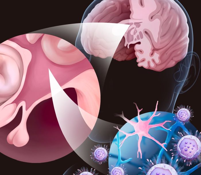 Brain inflammation by OSU