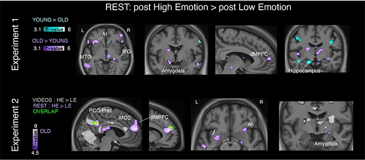 Brain scans pre post high emotion videos