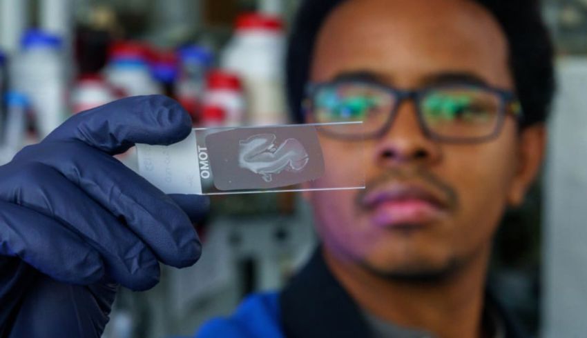 Brain tissue of person with Paisa Alz mutation by Chris Necuze FIU