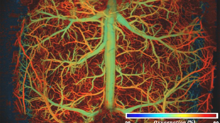 Brain vasculature under hypoxia