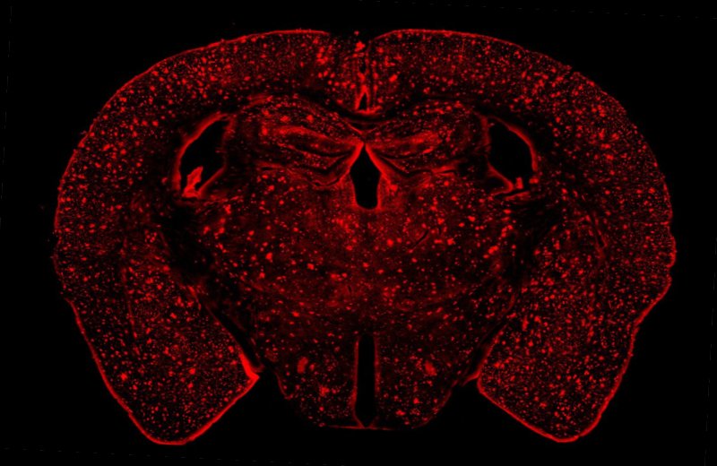 Brains plaques all over a mouse brain western university