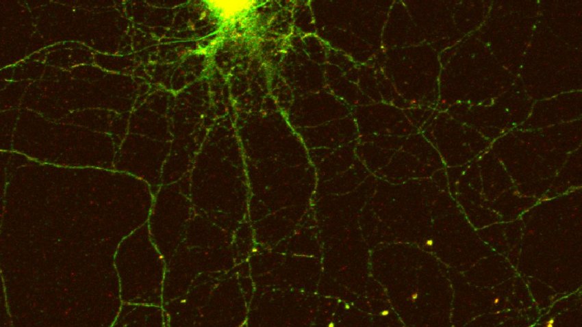 CPEB3 green localizing to a neuron s dendrites