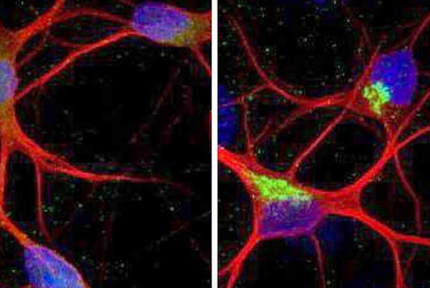 Control neurons and mis spliced KCNQ2 gene neurons