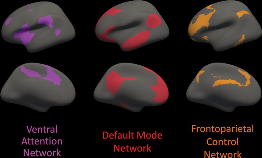 Cortical areas involved with each of the three distributed cortical association networks