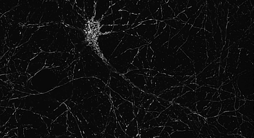 Cultured mouse neurons treated with a mitochondria protecting compound