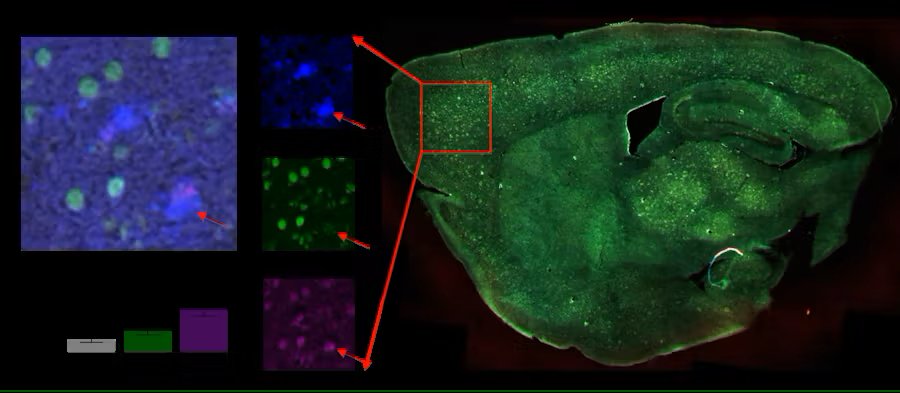 DNA based fluorescent sensors that can detect two different forms of iron