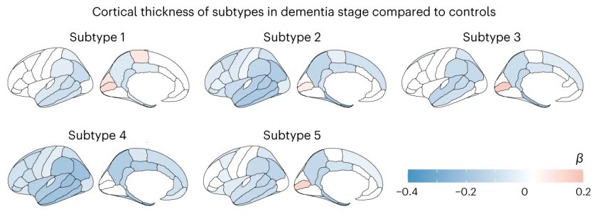 Different subtypes of Alzheimer
