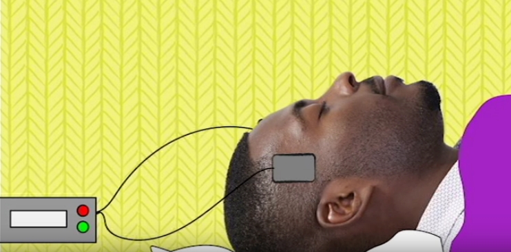 La stimolazione elettrica cerebrale durante il sonno può migliorare la memoria