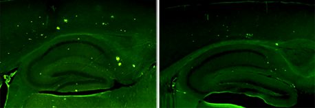 La proteina che (nei topi) riduce l'Alzheimer, non solo i sintomi