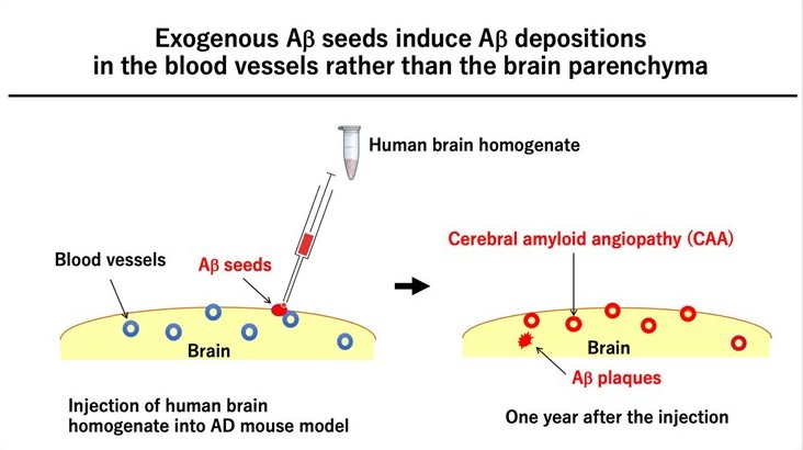 Exogenous Aβ seeds induce Aβ depositions in blood vessels