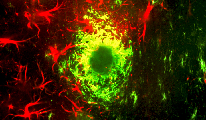Farmaco sperimentale anticancro ripristina la memoria in topi di Alzheimer