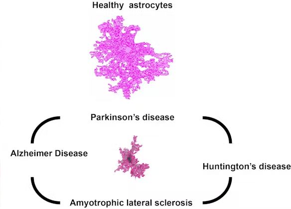 Healthy and diseased astrocyte