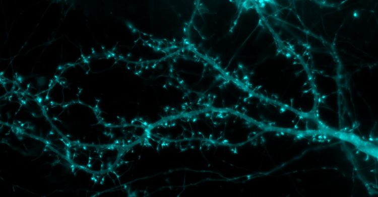 Hippocampal neurons with spines