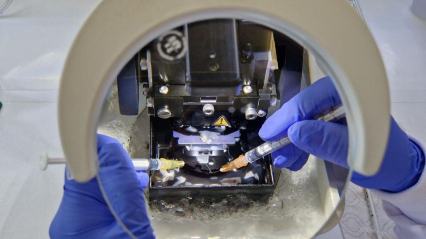 Human brain tissue sectioned into thin slices using a vibratome by uni edinburgh