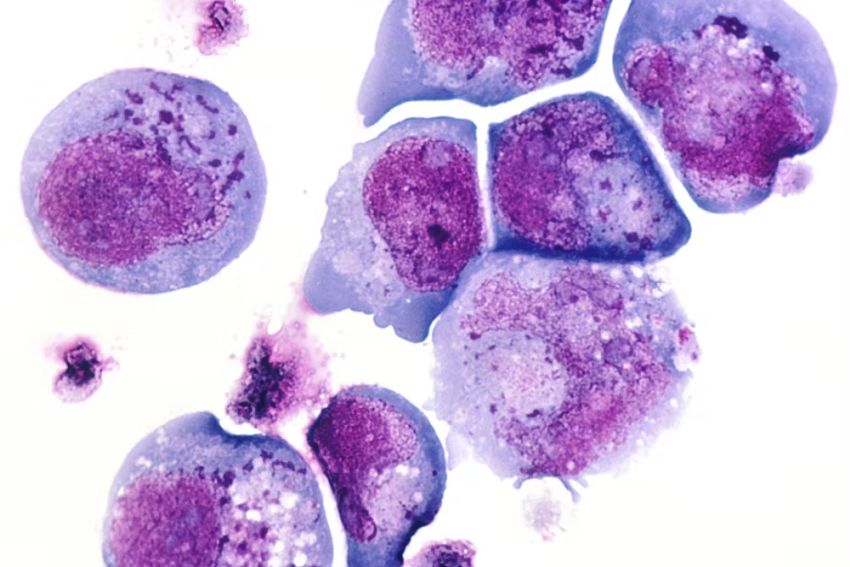 Inclusion bodies magenta are aggregates of proteins that form a type of biomolecular condensate National Cancer Institute
