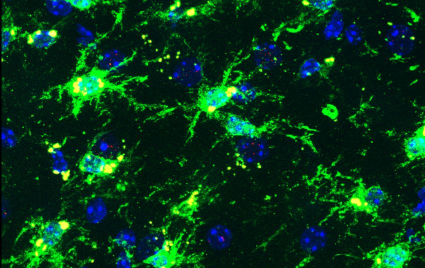 Inflammatory microglia in female mouse brain of MA with yellow dots senescence