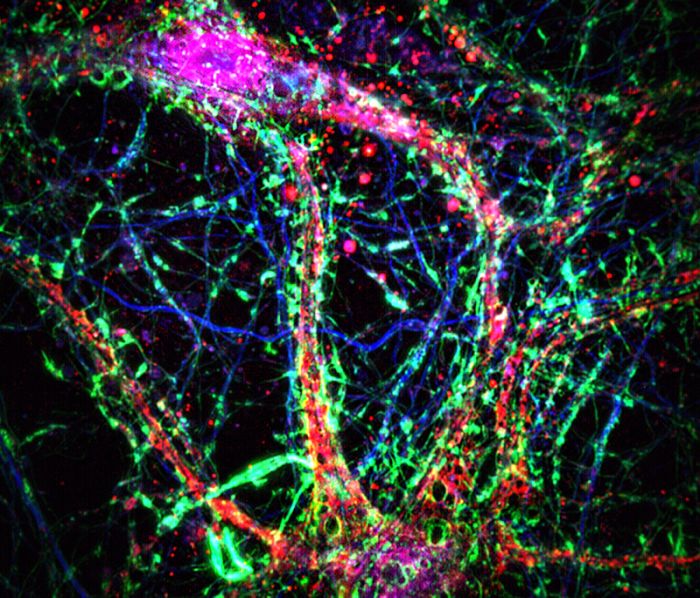 Intracellular nanotubes