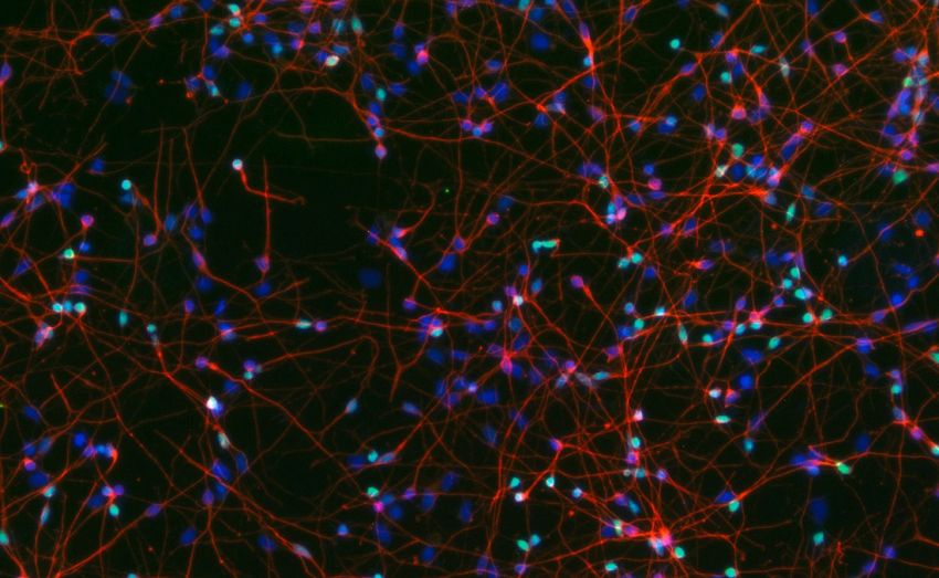 Lab grown brain cells derived from human stem cells
