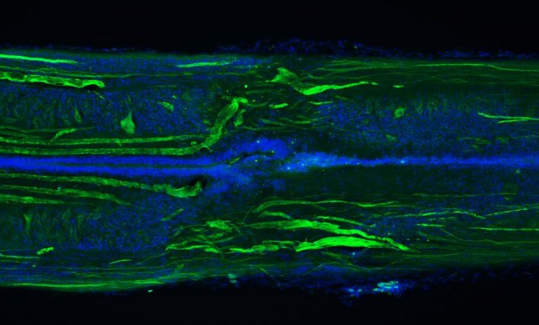 Lamprey Regenerated Spinal Cord